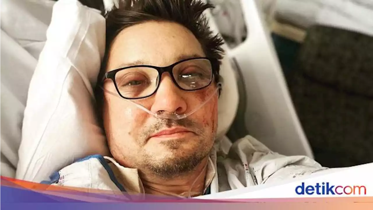 Kondisi Terkini Jeremy Renner Usai Alami 30 Tulang Patah