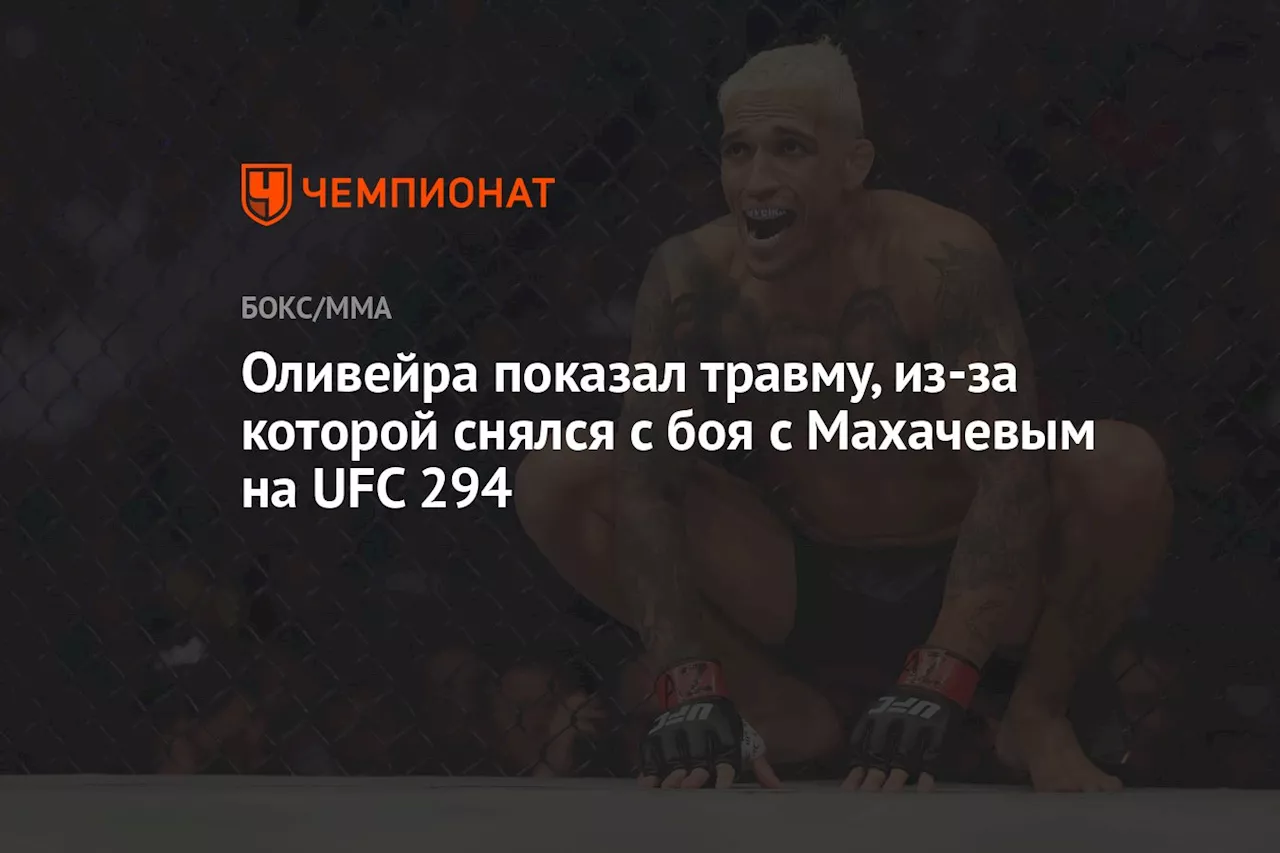 Оливейра показал травму, из-за которой снялся с боя с Махачевым на UFC 294