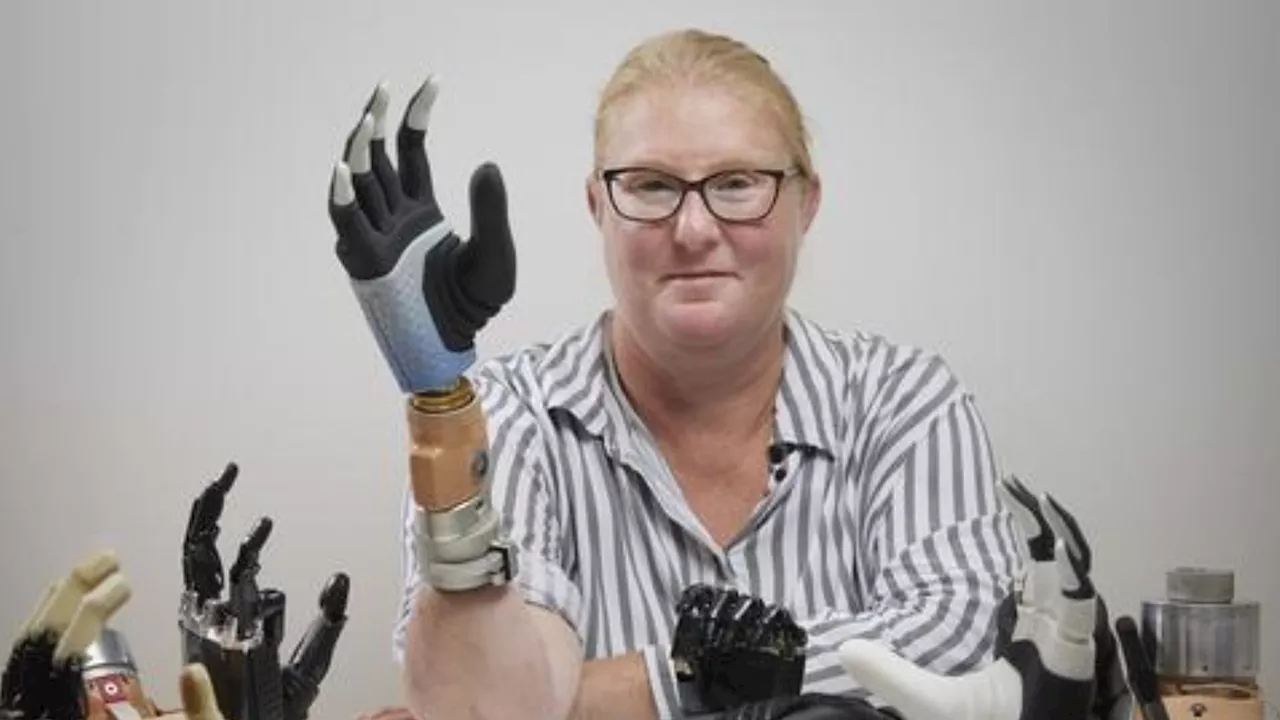 Bionic hand solves user's pains in more than one way