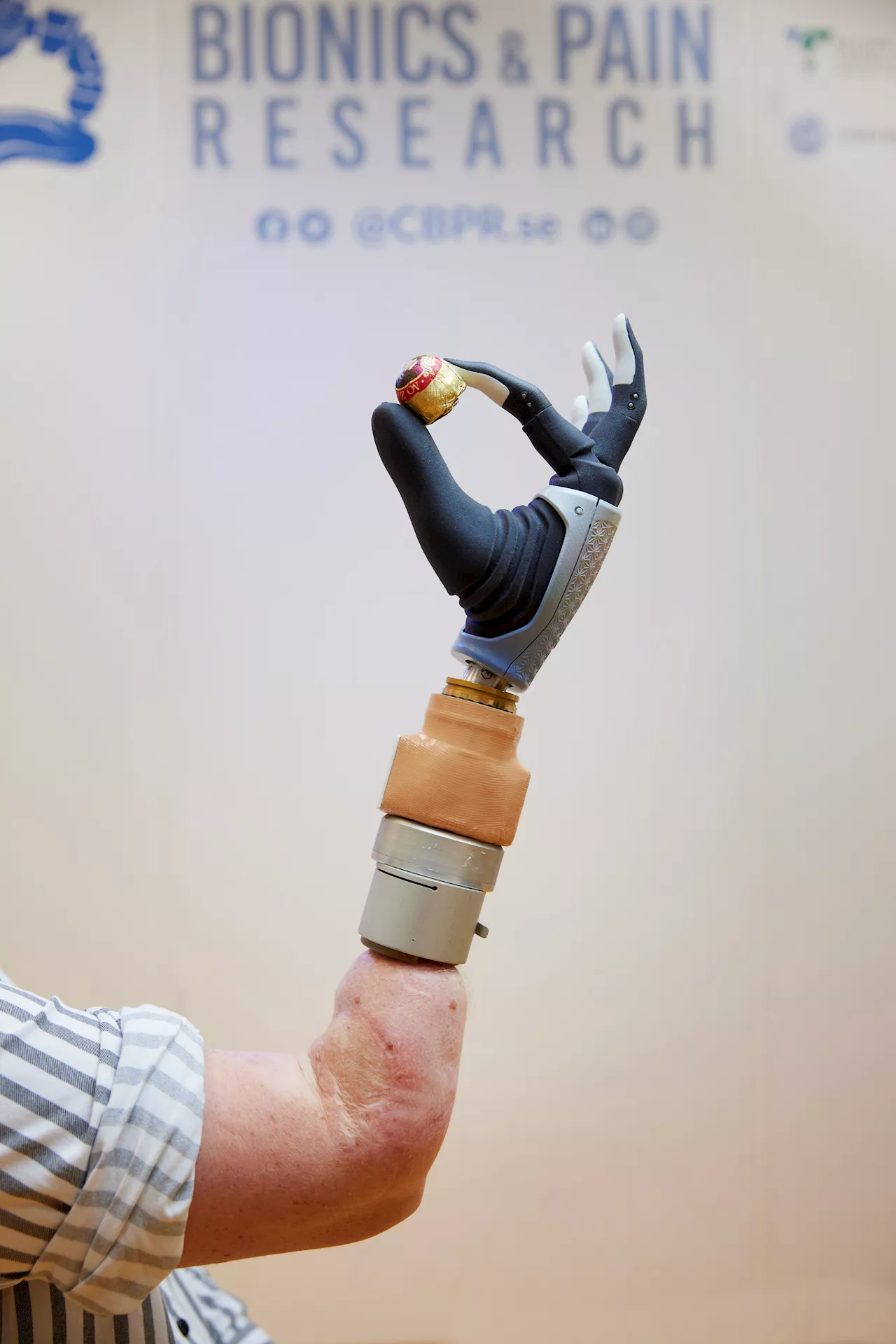 Bionic hand merges with user's nervous and skeletal systems, remaining functional after years of daily use