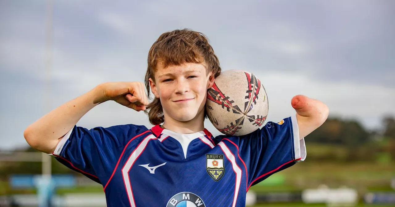 Rugby-mad lad born without arm to carry ball out for World Cup final