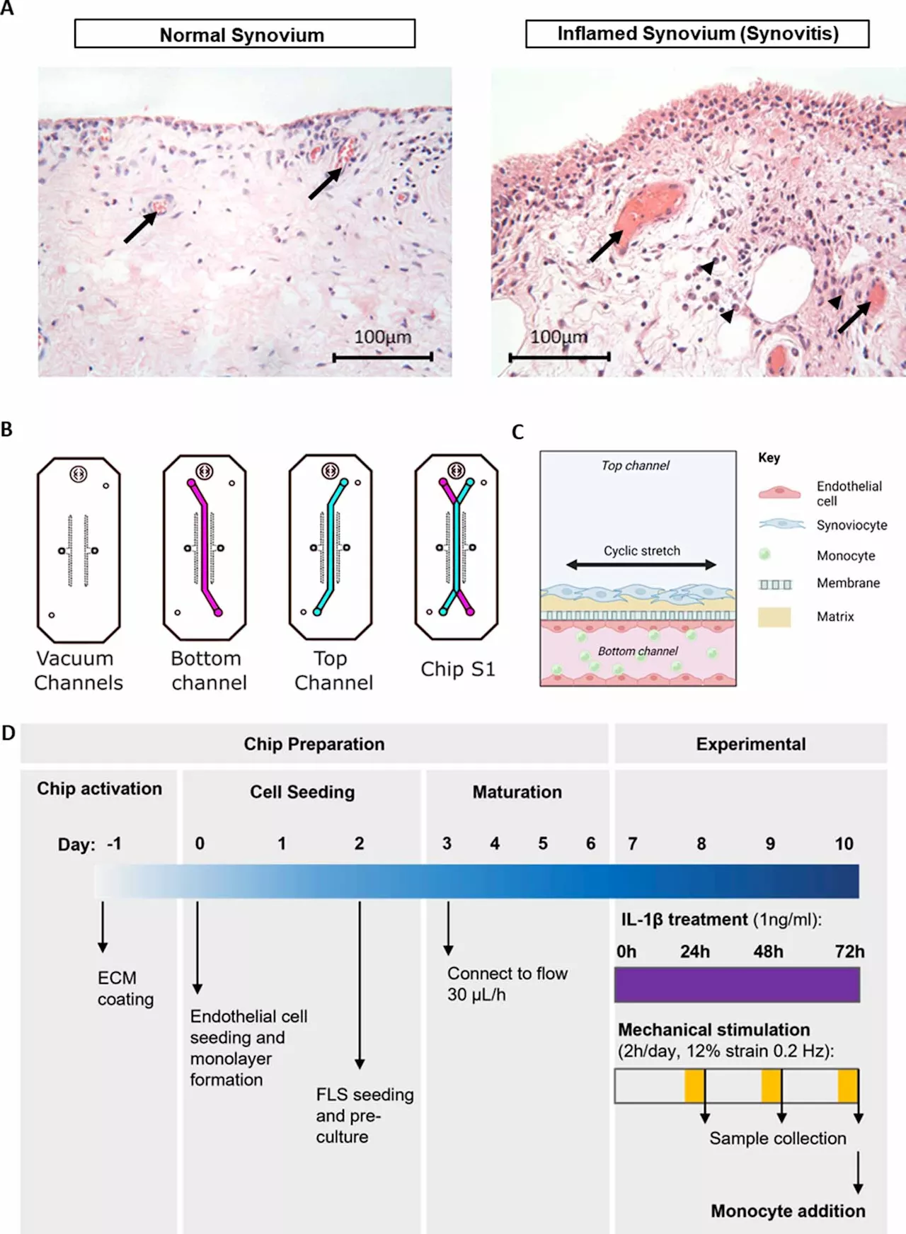 New organ-on-a-chip model of human synovium could accelerate development of treatments for arthritis