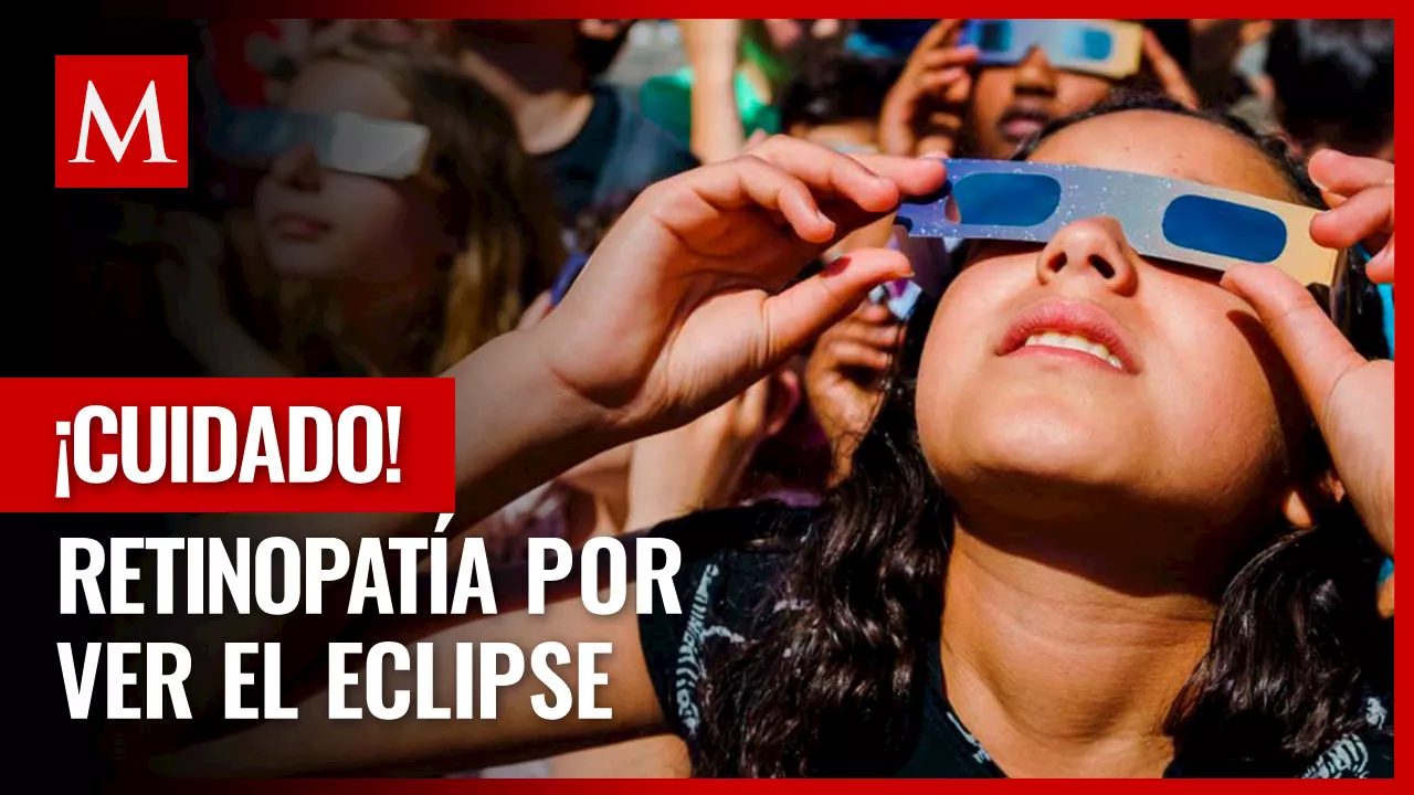 Protegiendo tus Ojos: Medidas para Evitar Retinopatía Solar en el Eclipse 2023