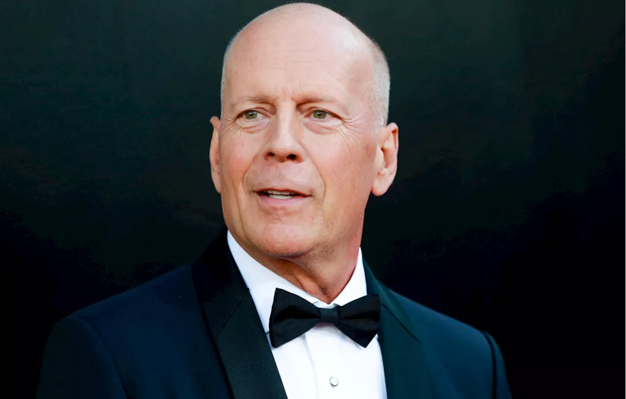 Bruce Willis Not Totally Verbal Amid Dementia, Says Moonlighting Creator