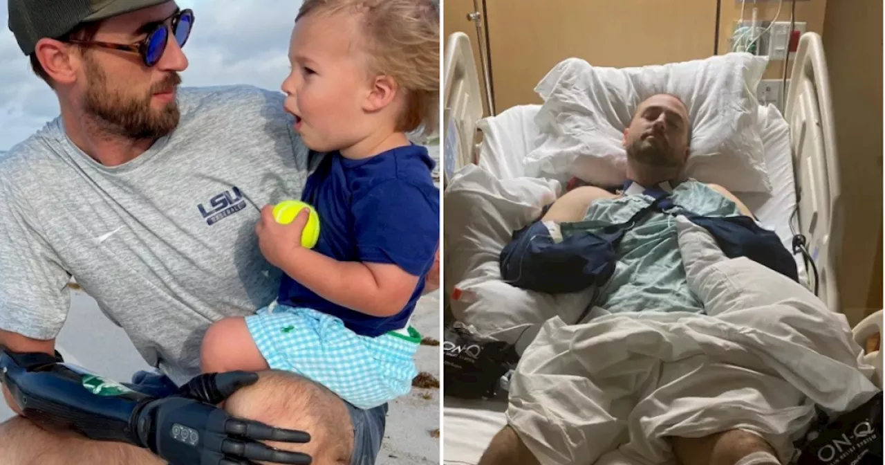 Dad gets bionic arm after losing his hands in machine at work