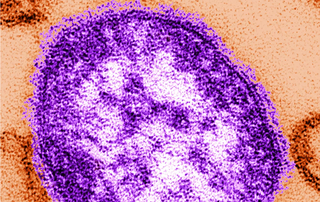 First measles case in Illinois since 2019 confirmed in Cook County