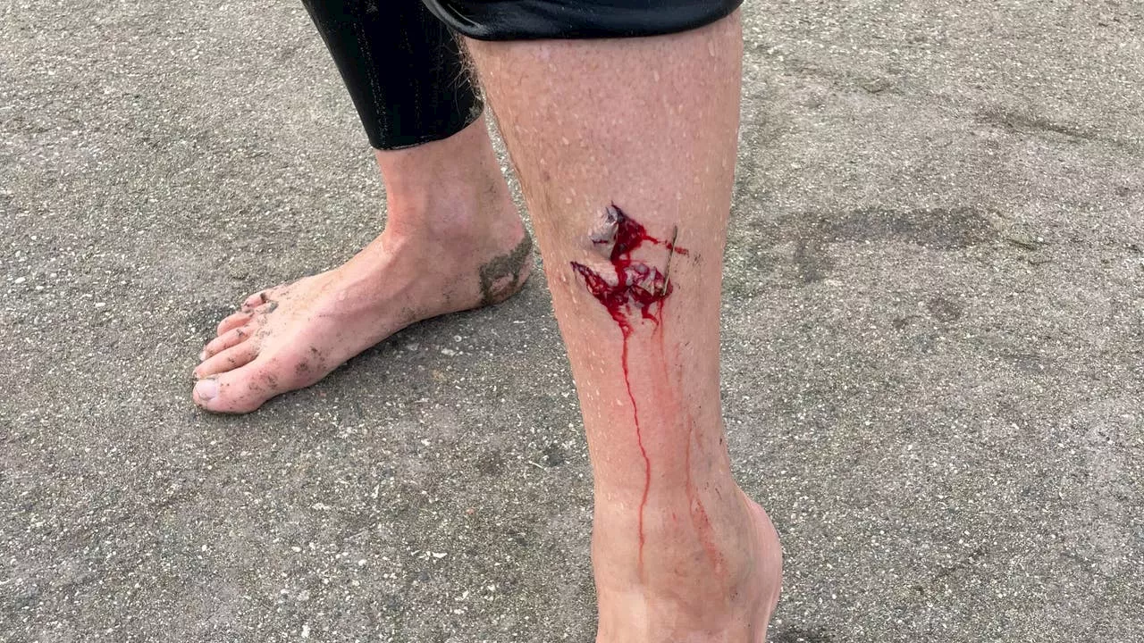 Surfer apparently bitten by a shark at Linda Mar in Pacifica