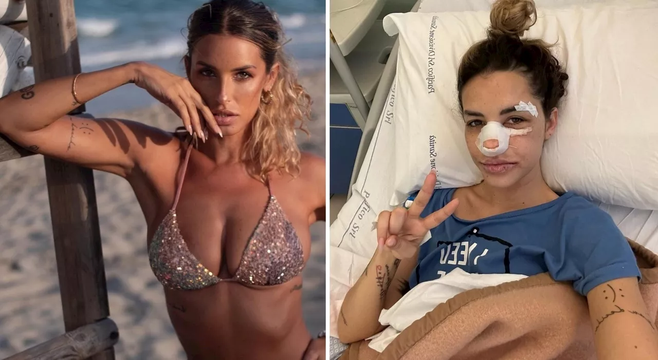 Carlotta Adacher «deforme», l'ex Temptation Island: ecco come sono diventata dopo l'incidente e gli interventi