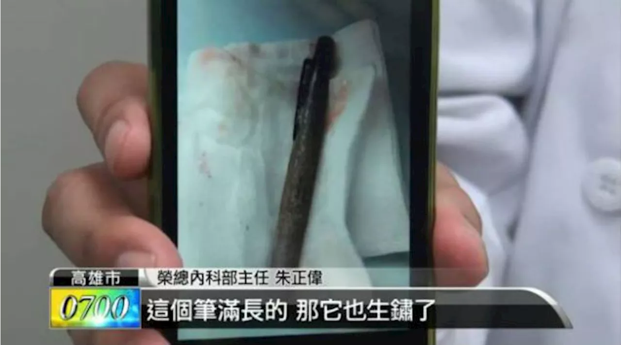 This Can’t Be Write? Woman Finds Pen Lodged In Stomach For Six Months