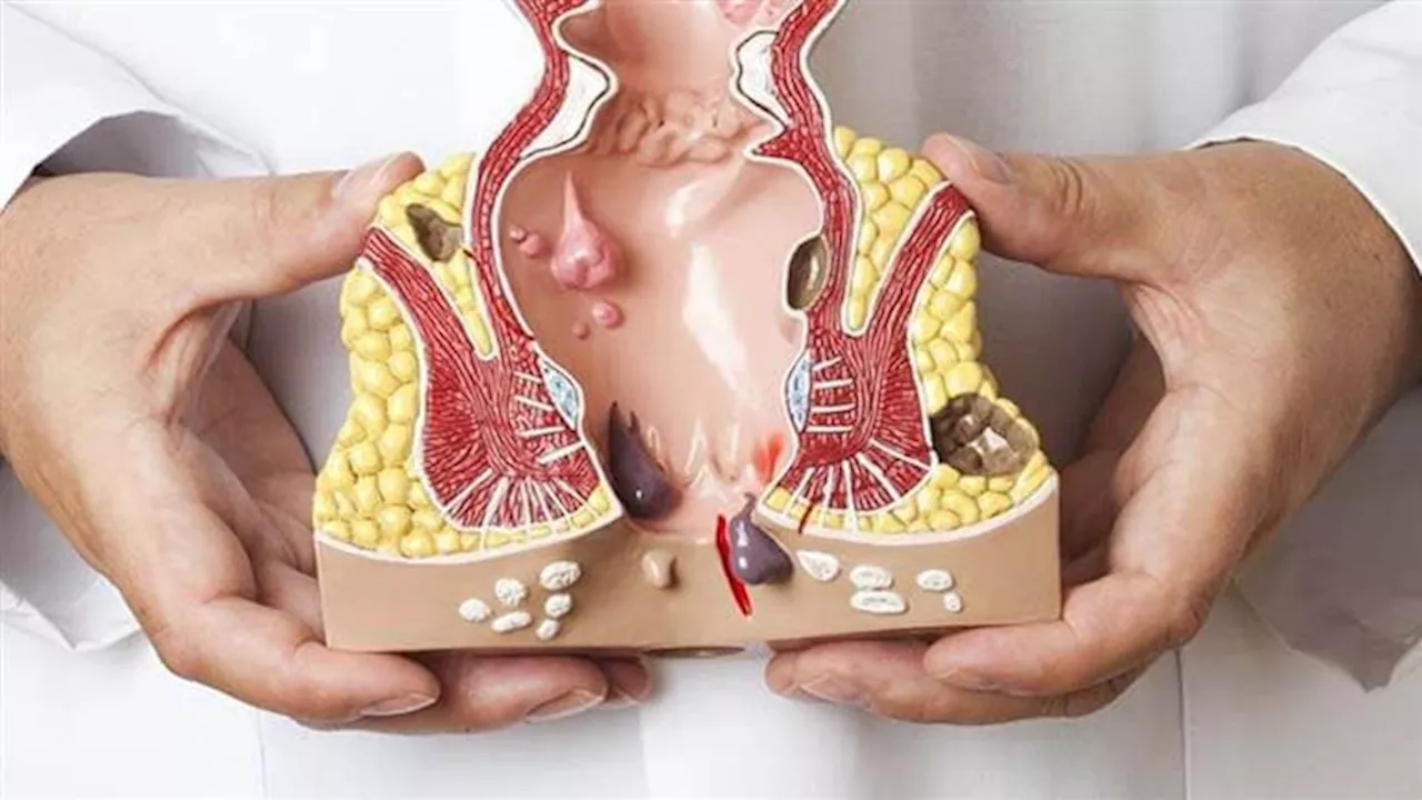 لن تتوقعها.. علامات إذا ظهروا عليك دليل على سرطان الشرج