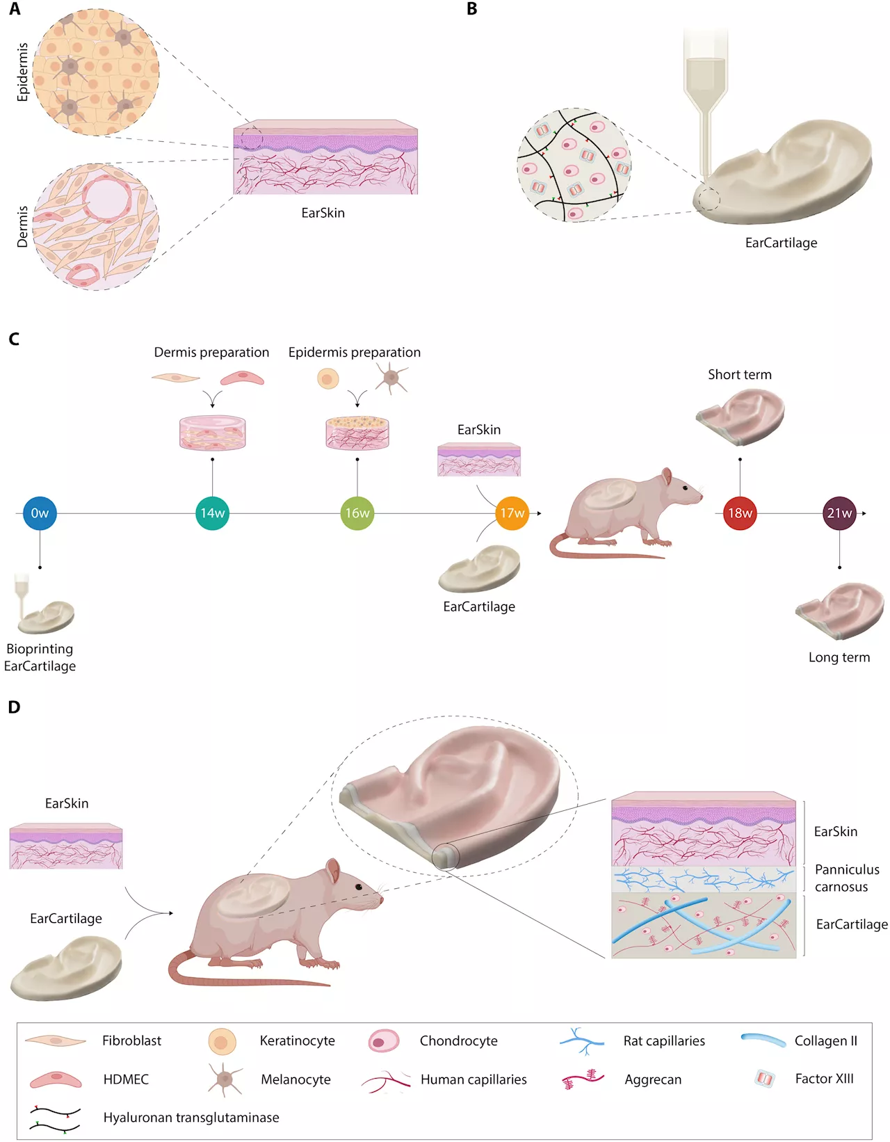 EarSkin and EarCartilage—combining bioengineered human skin with bioprinted cartilage for ear reconstruction