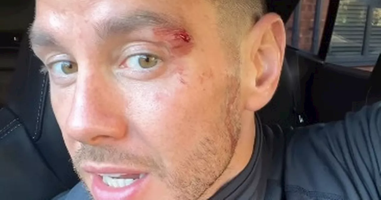 Scott Thomas shows off bloodied face and injuries after nasty sports accident