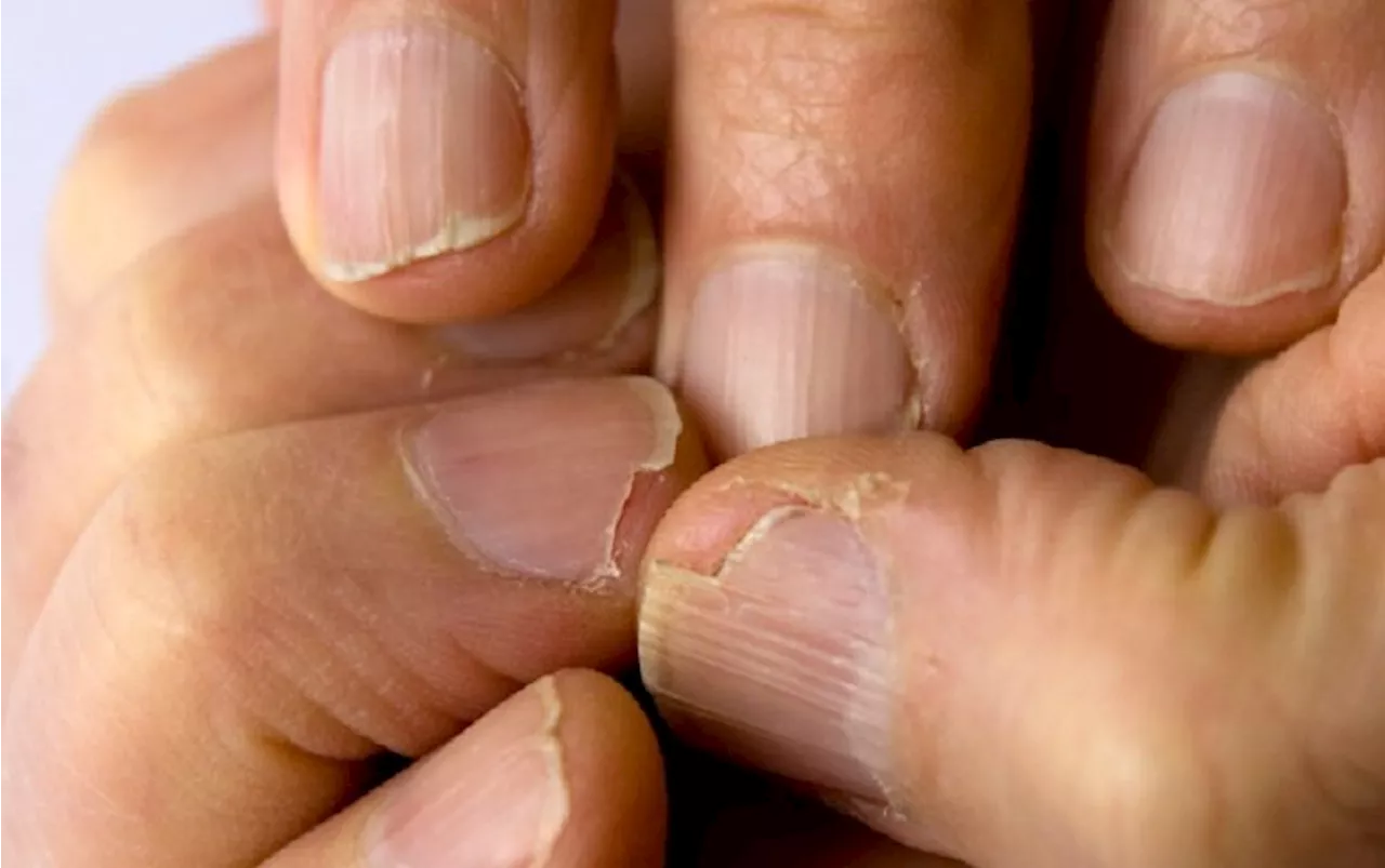 This One Kitchen Staple Is The Trick To Growing Stronger, Longer Nails