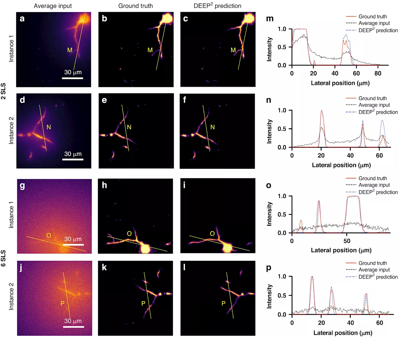 Machine learning techniques give scientists faster returns of high-quality organ images