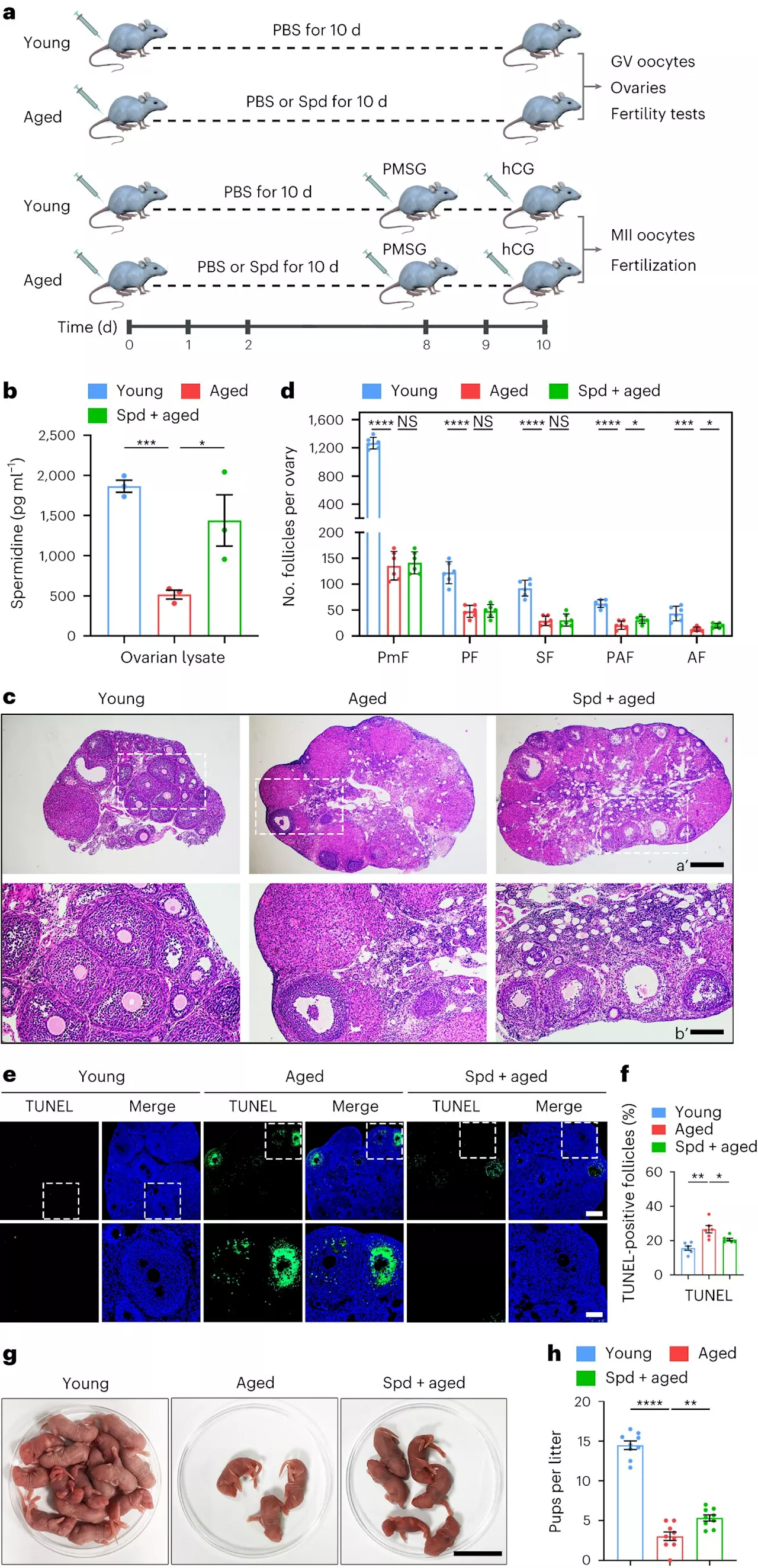 Spermidine found to rejuvenate oocyte quality by improving mitophagy during female reproductive aging