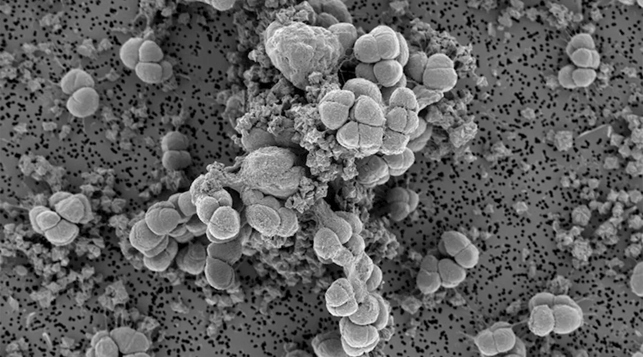 Ancient nickel-eating microbes can teach us valuable biomining techniques