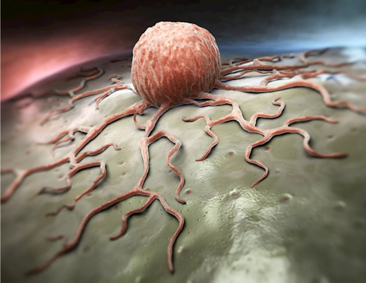 Fluorescence lifetime imaging shows promise for improved tumor detection