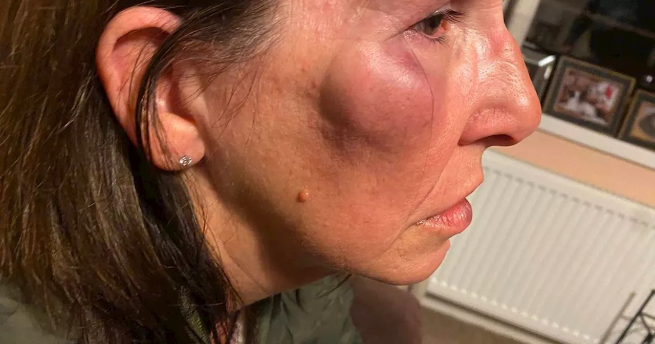 Attackers slammed woman's face into wall and stole her dog