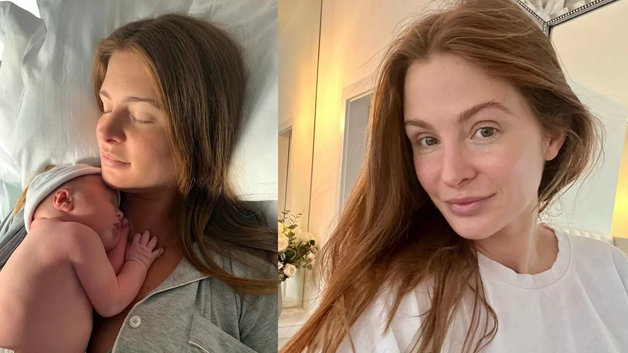 Millie Mackintosh Reveals The £25 C-Section Scar Cream She Swears By