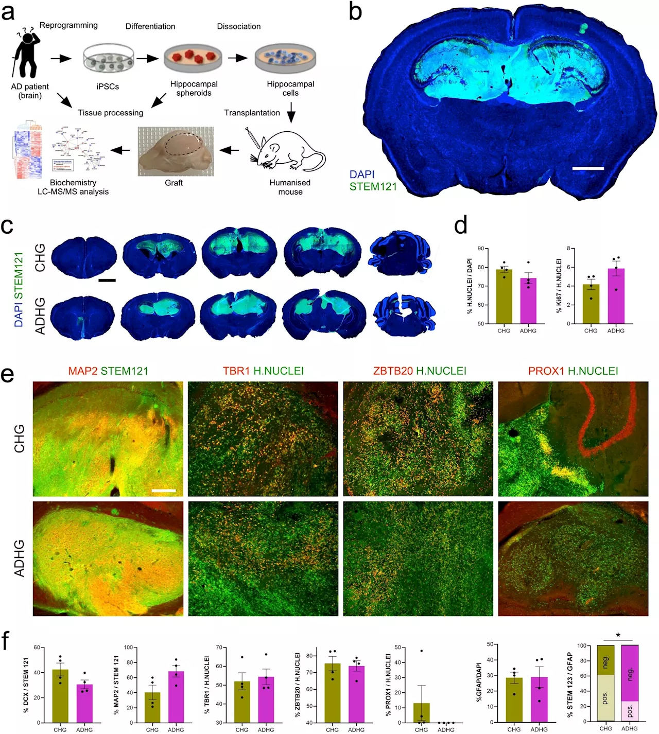 New model leverages stem cells to provide window into Alzheimer's disease development