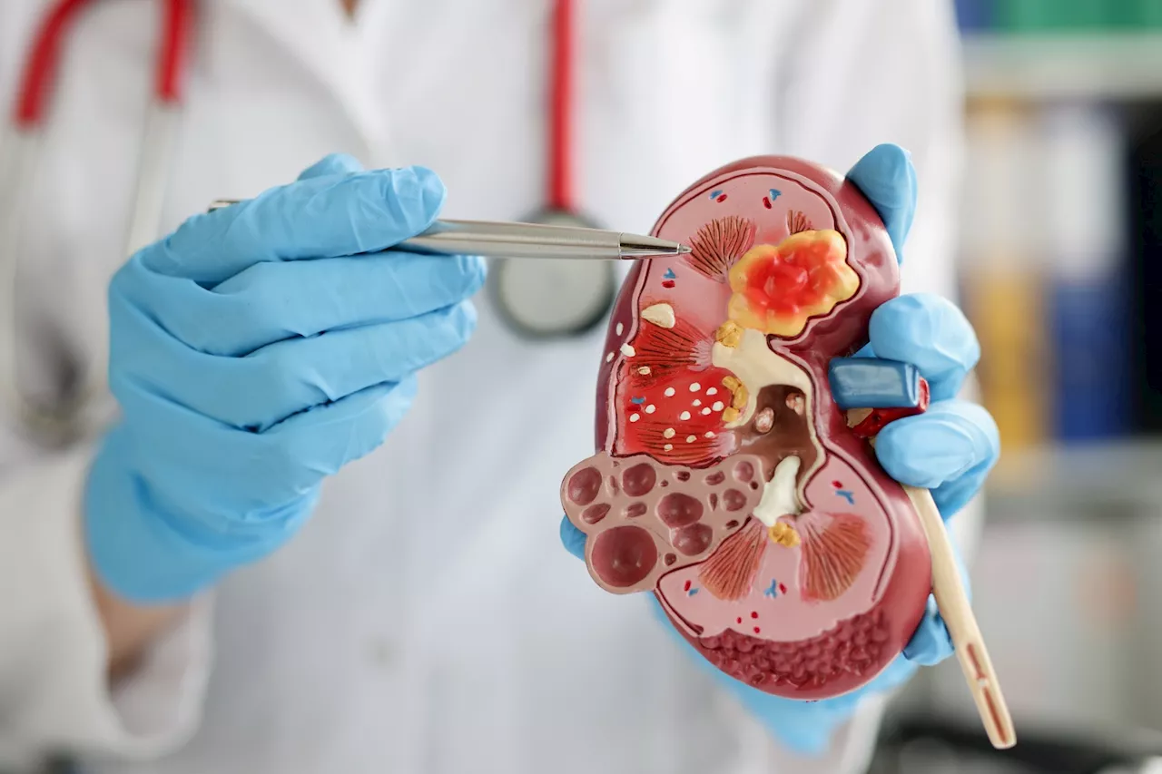 Kidney transplantation turns back the clock on renal aging