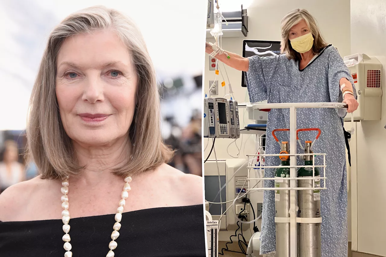 'Castle' actress Susan Sullivan reveals she underwent surgery following lung cancer diagnosis