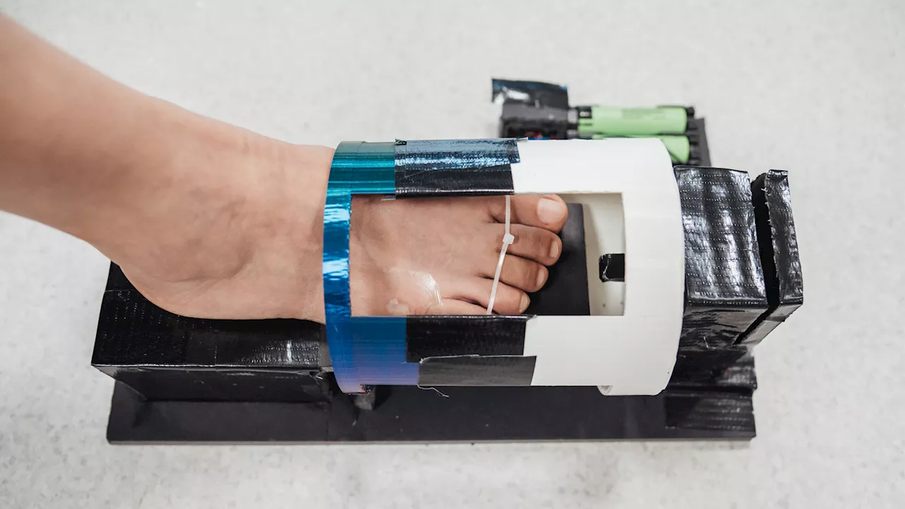 Scientists develop innovative magnetic gel that heals diabetic wounds three times faster