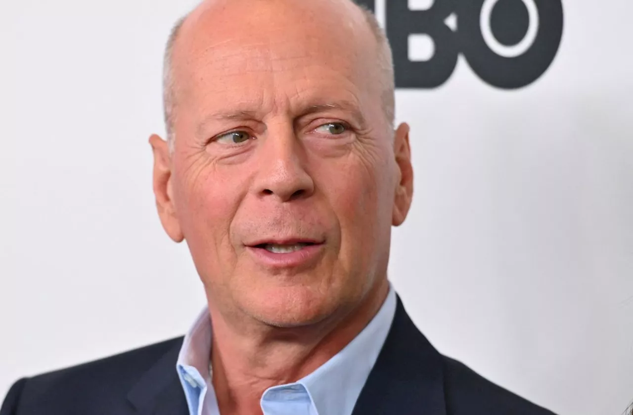 Bruce Willis is 'incommunicative' and 'not totally verbal' now, 'Moonlighting' creator says