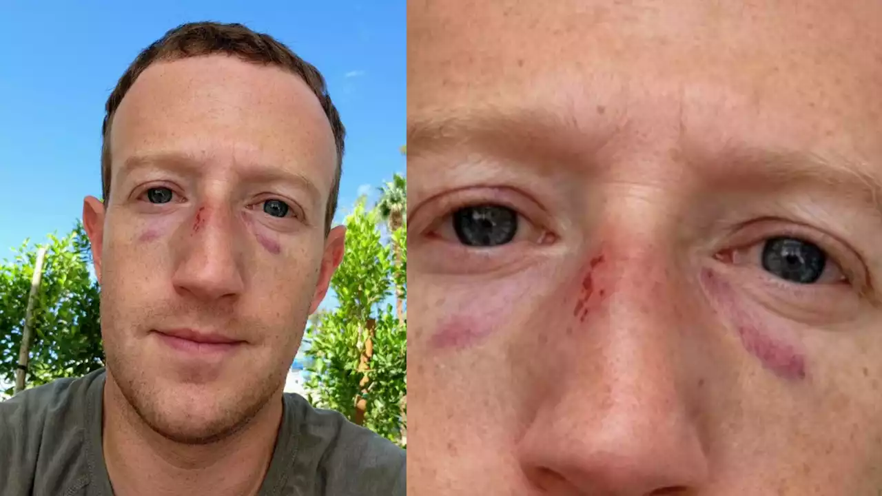 Mark Zuckerberg posta foto com hematomas no rosto depois de luta