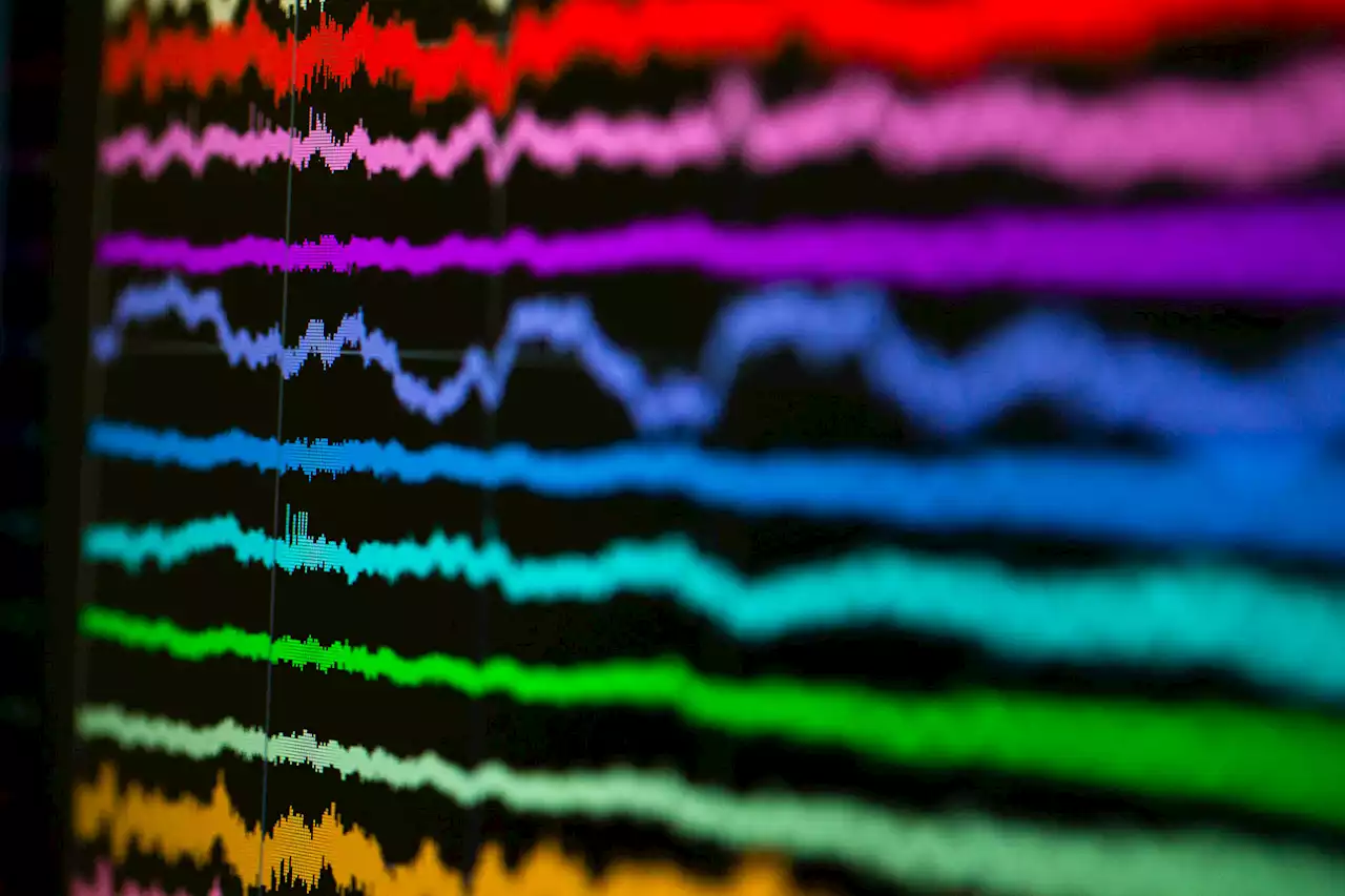 Nerve cells can detect small numbers of things better than large numbers of things, study shows