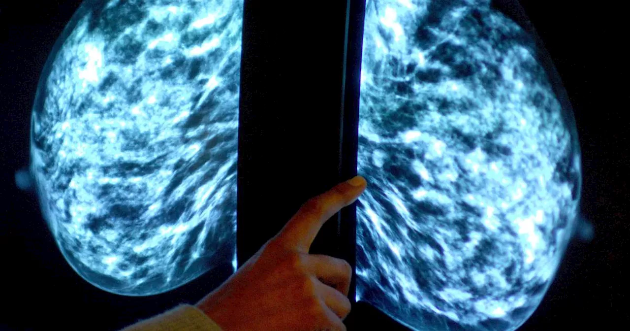 Breast cancer screening ‘doesn’t make much of a difference’ to death rates, says oncologist