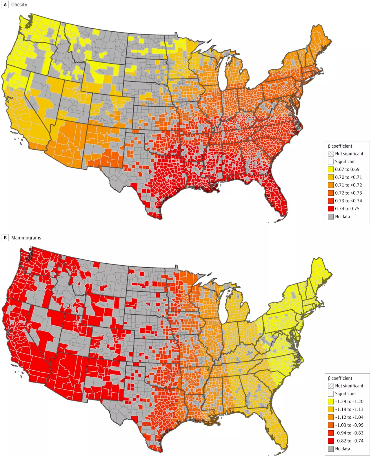 With breast cancer risks, where you live matters, researchers find