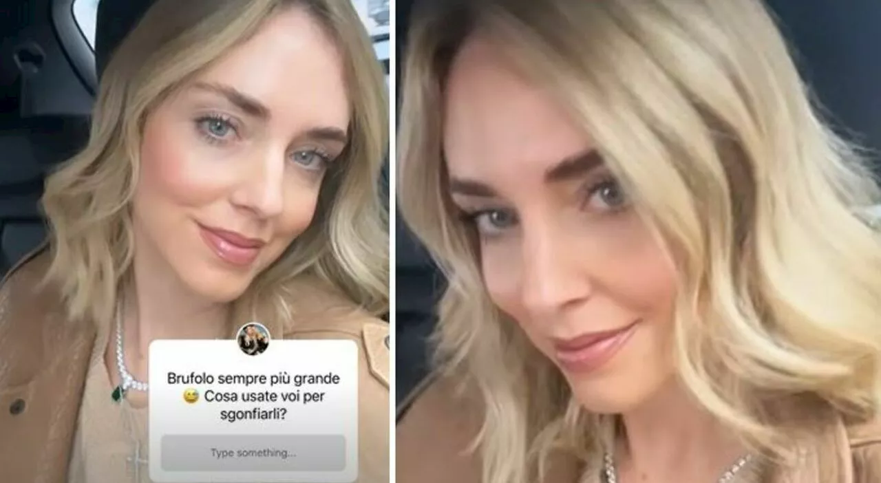 Chiara Ferragni, problemino estetico e chiede aiuto ai fan: «Sempre più grande... Come fate?»