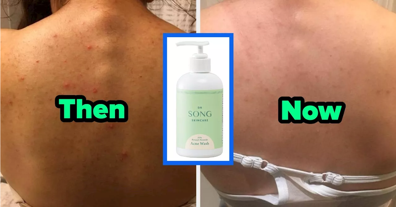 30 Skincare Products Reviewers Used When Nothing Else Worked