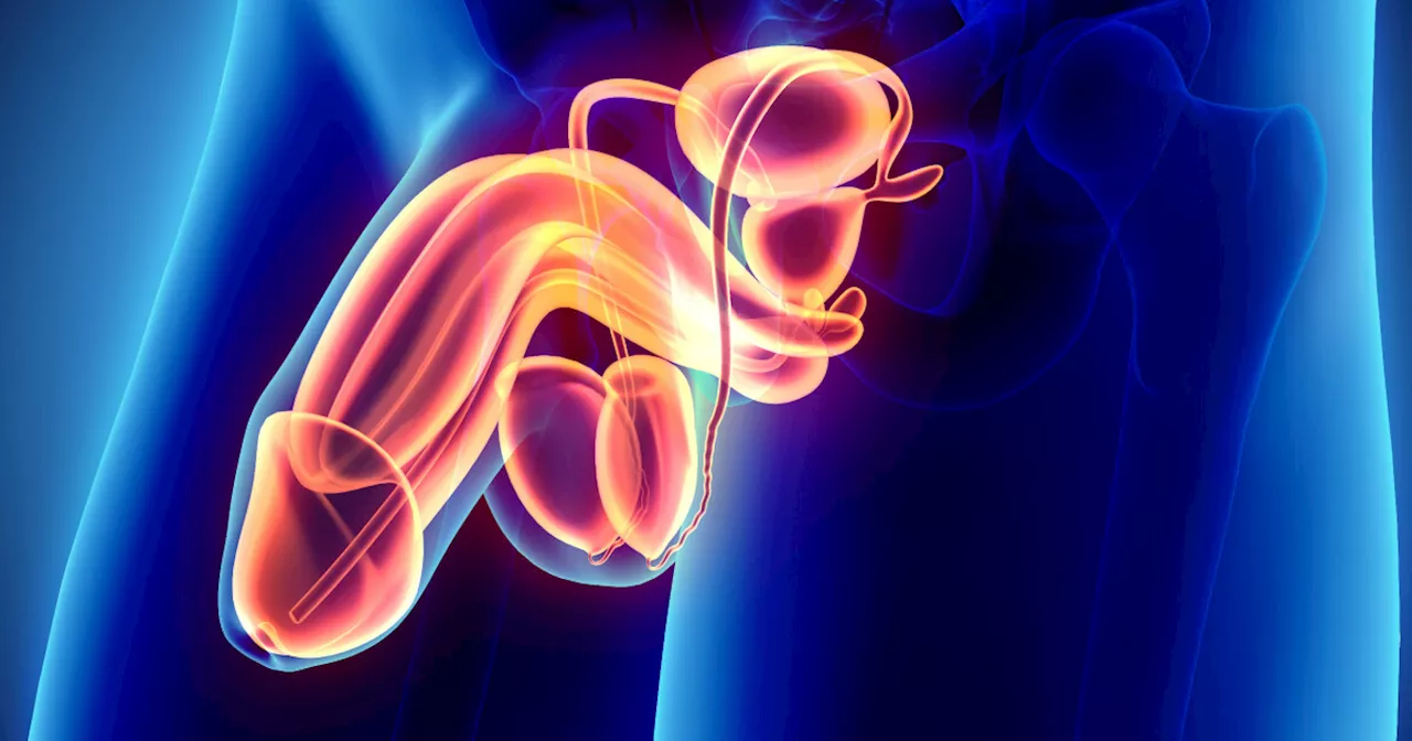 Urolog: Beste metoden mot skjev penis