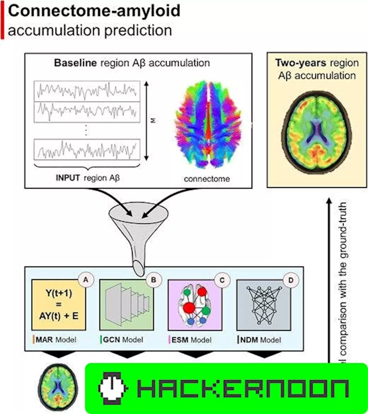 Revolutionizing Alzheimer's Disease Prognisis with Machine Learning