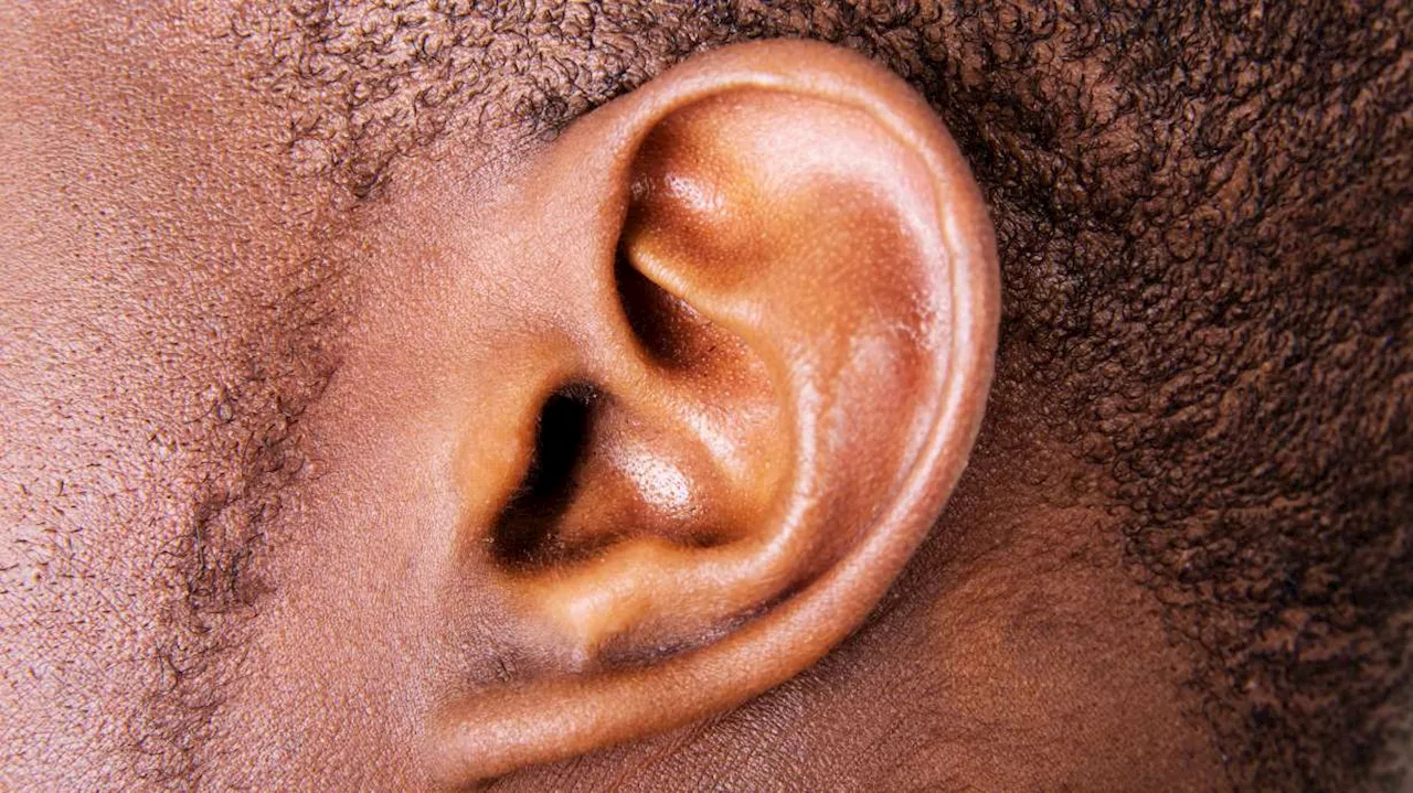 Researchers bioengineer skin, bioprint cartilage to fix ear malformation