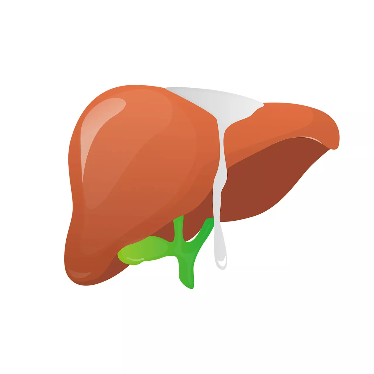 Clinical trial of adjuvant therapy combination shows improved recurrence-free survival in liver cancer patients