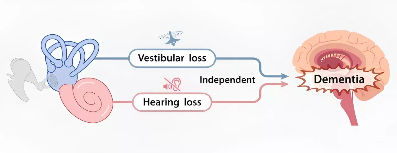 New large-scale study results add to evidence that vestibular loss increases dementia risk