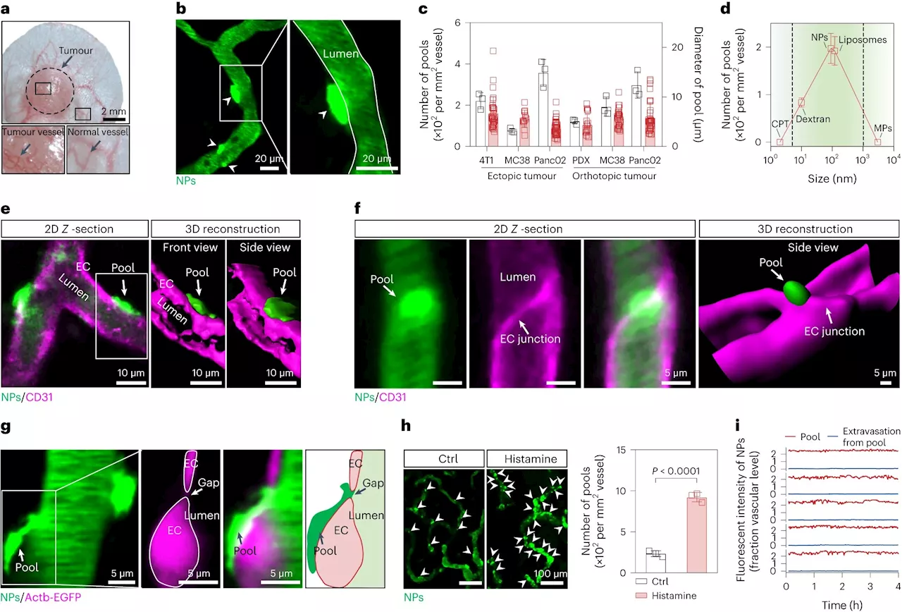 Researchers propose new strategy to improve efficiency for nanotherapeutic delivery in tumors