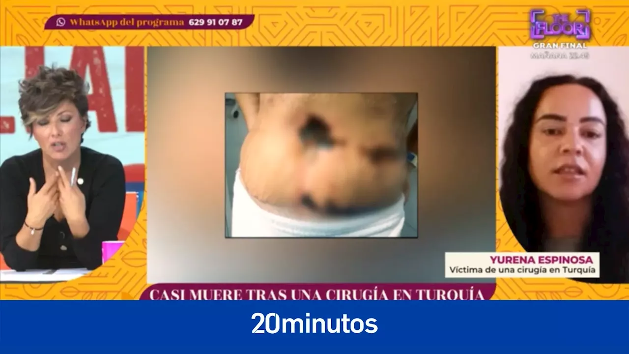 'Y ahora Sonsoles': Una mujer sufre una negligencia en una abdominoplastia en Turquía: 'Llegué a España y estaba casi para morirme'