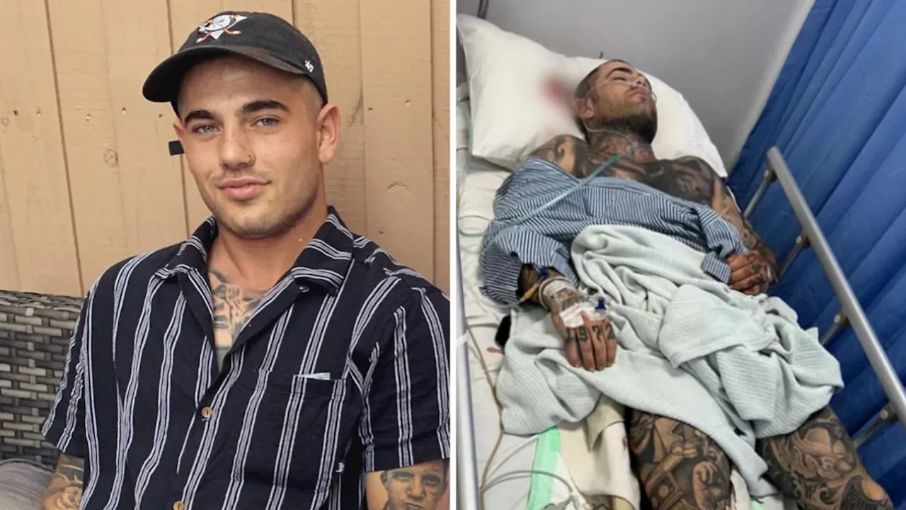 Young Melbourne man forced to decide whether to amputate leg following serious hit-and-run in Bali