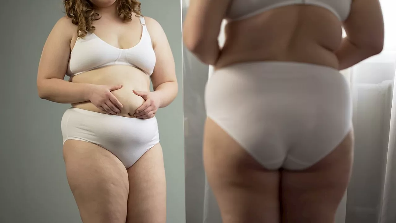 Scientists claim to have found root cause of obesity for most people