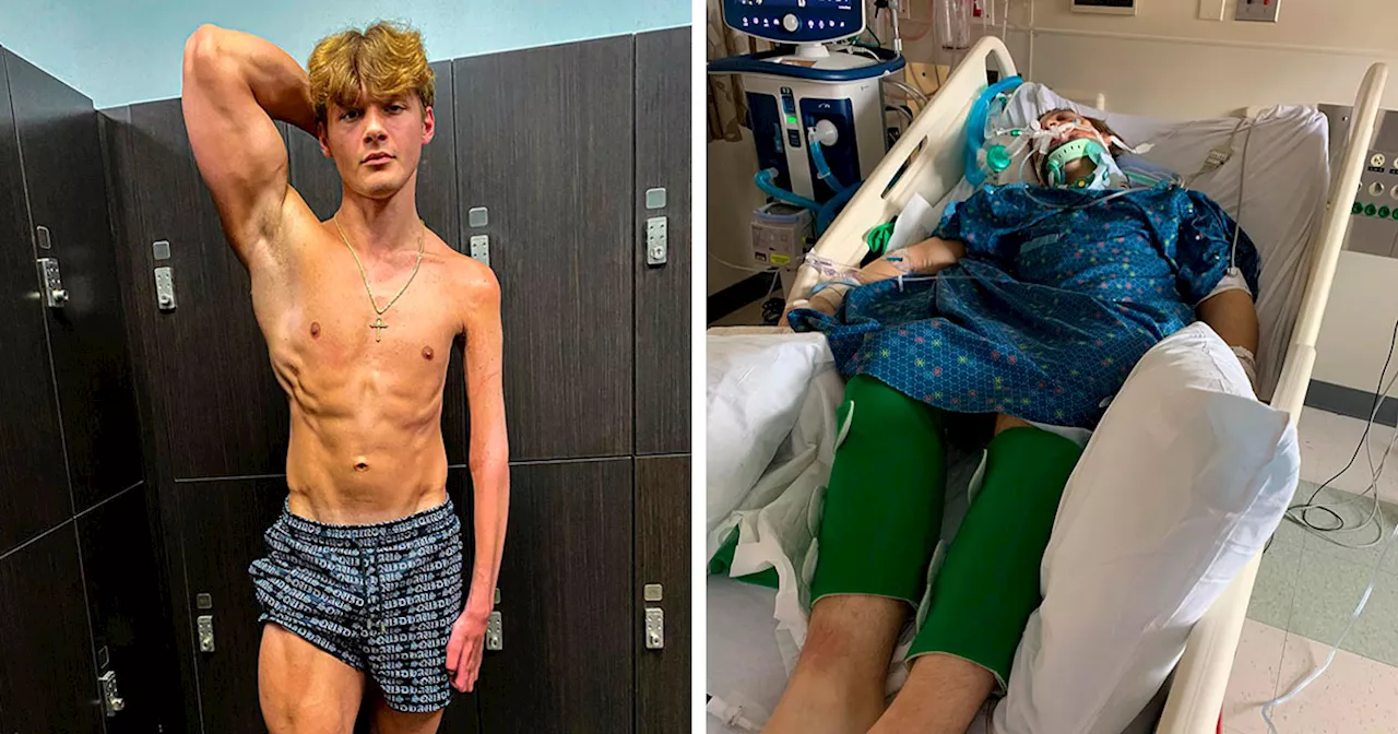 19-Year-Old Stuns People Online After Revealing Reason Why Right Arm Bigger Than His Left