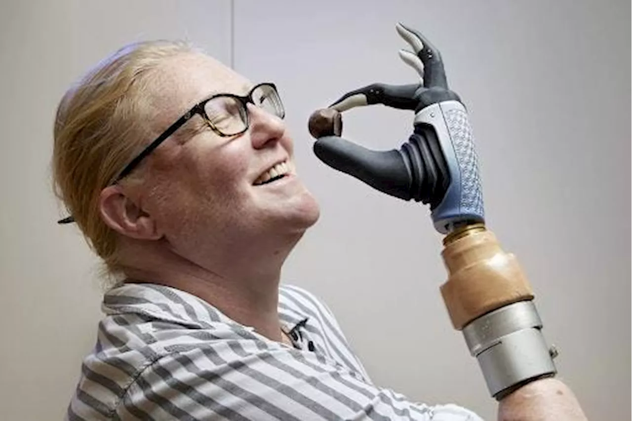 Bionic Breakthrough: The Future Of Bioelectronic Prosthetics