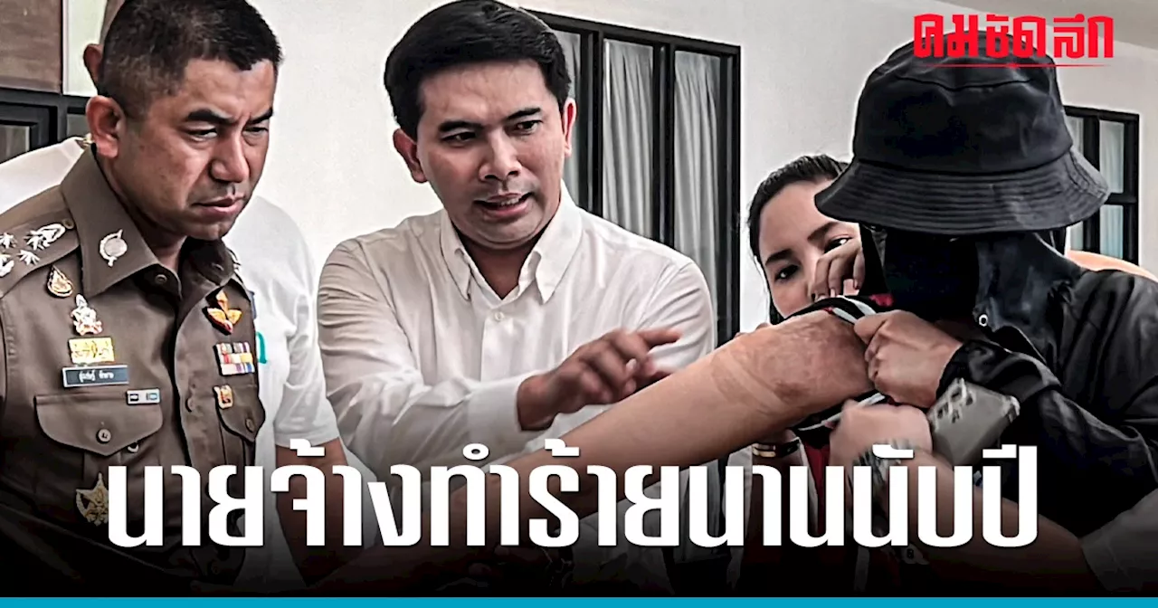 'สายไหมต้องรอด' พาสาว 21 ร้อง 'บิ๊กโจ๊ก' ถูกนายจ้างจุดไฟเผาทำร้ายนานนับปี