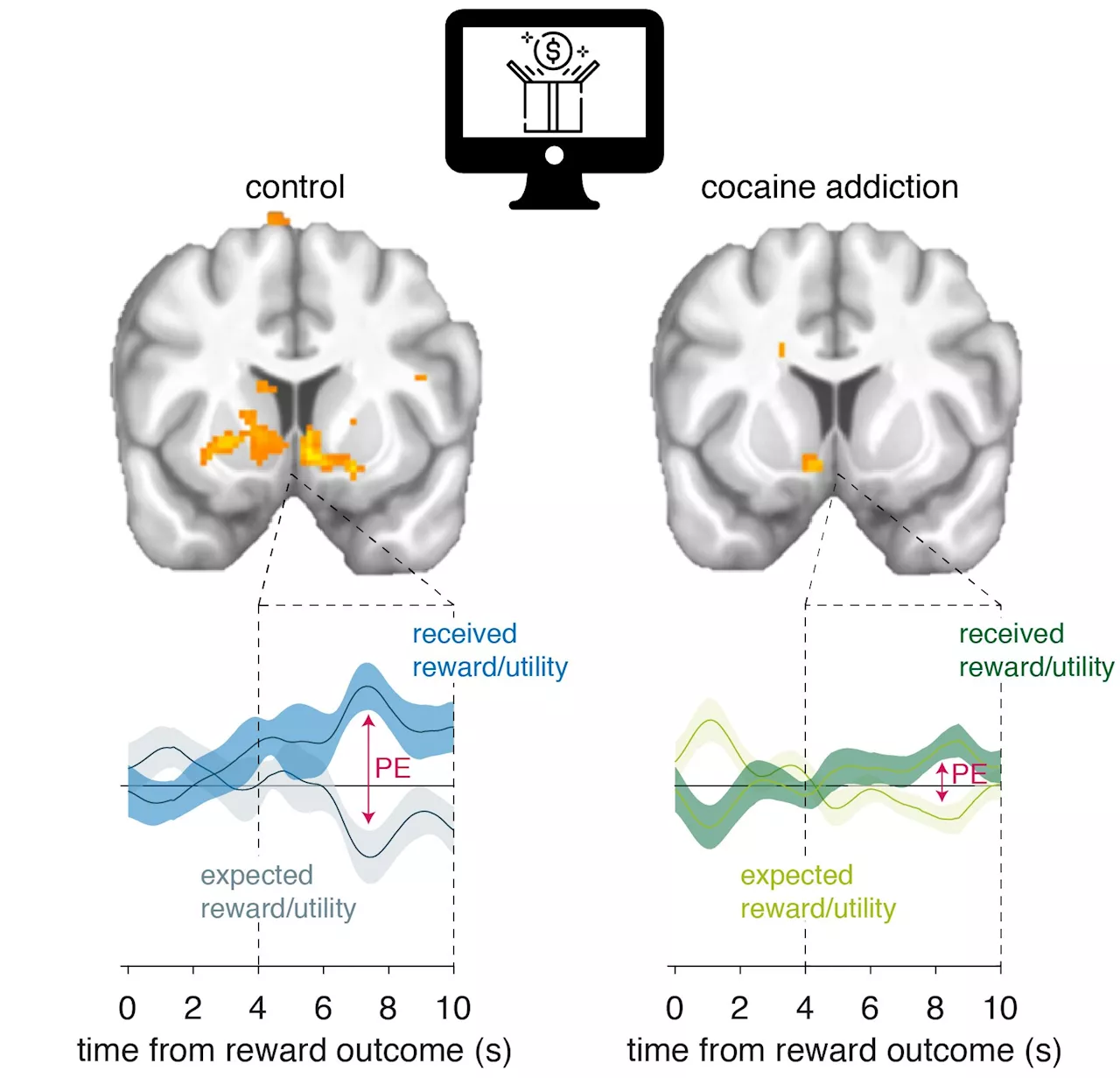 Perception—but not expectation—of reward is altered in people with cocaine addiction