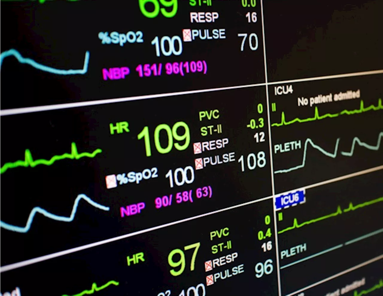 Global clinical trial provides new evidence on simvastatin and vitamin C for COVID-19