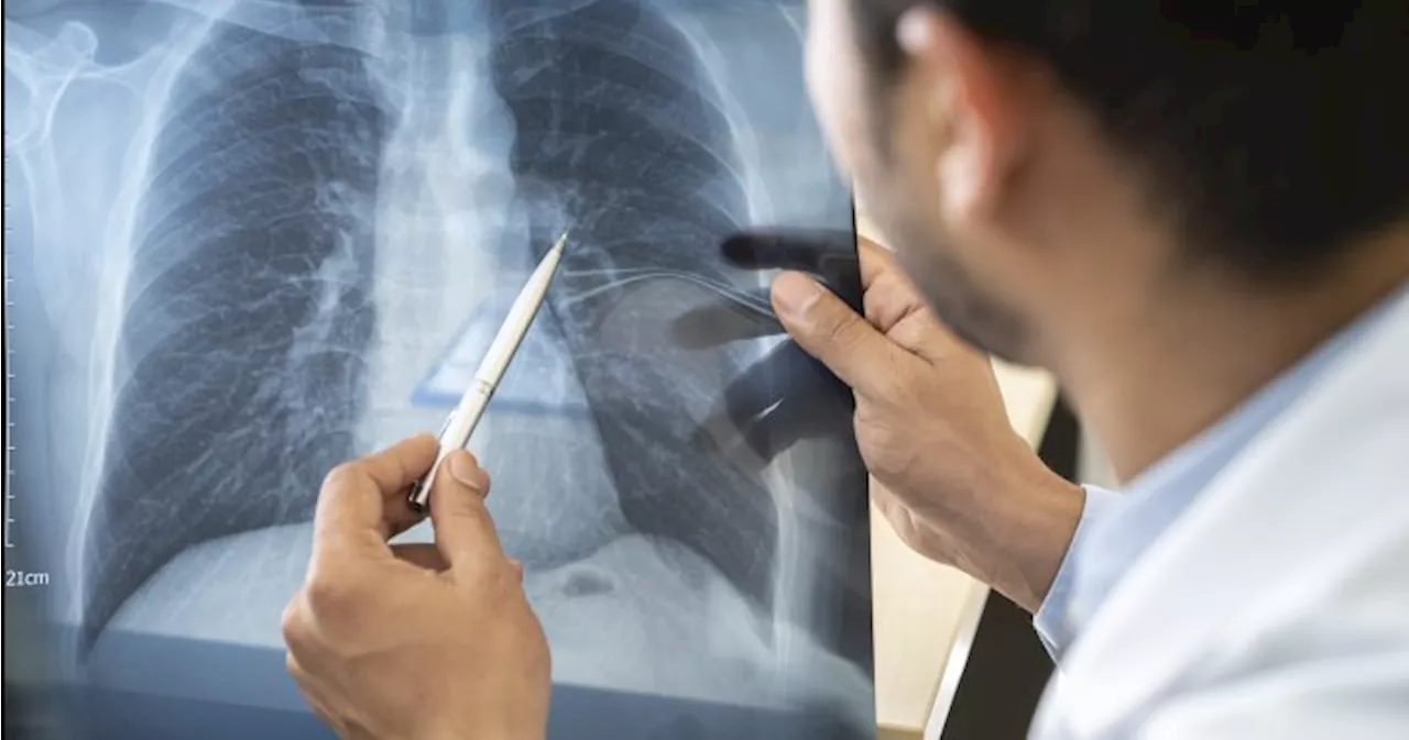 Sask. Blue Cross collaborates with Lung Saskatchewan for Long COVID project