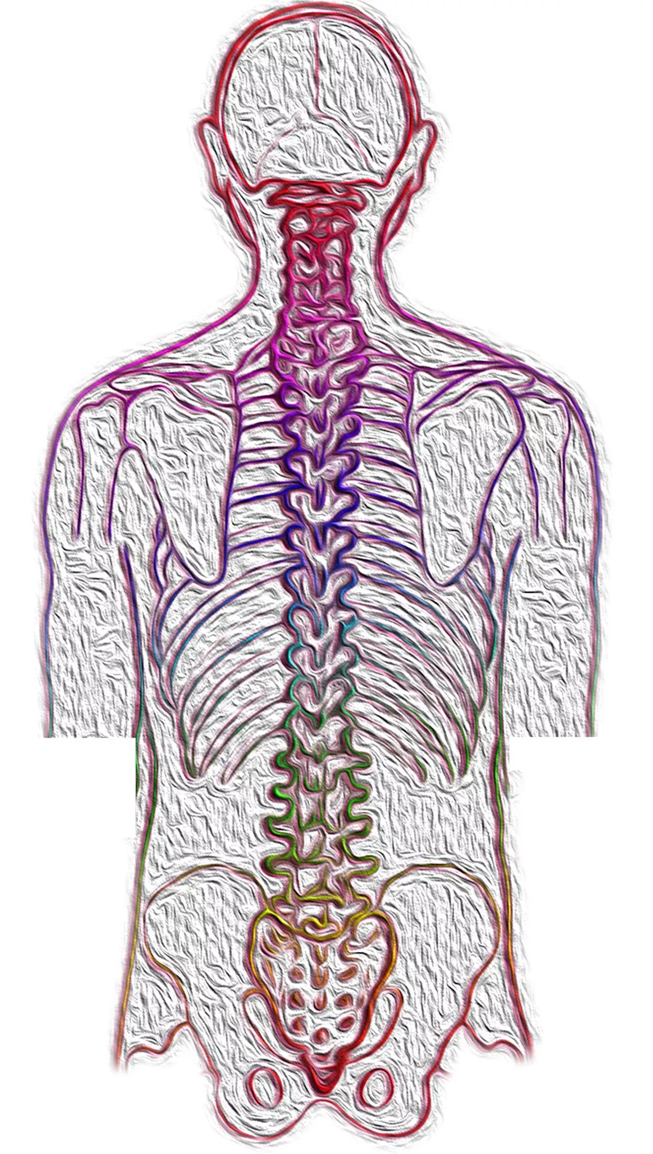 Black and low-income teens have more ED visits, major complications after scoliosis surgery